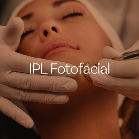 IPL Fotofacial (AZ Only)