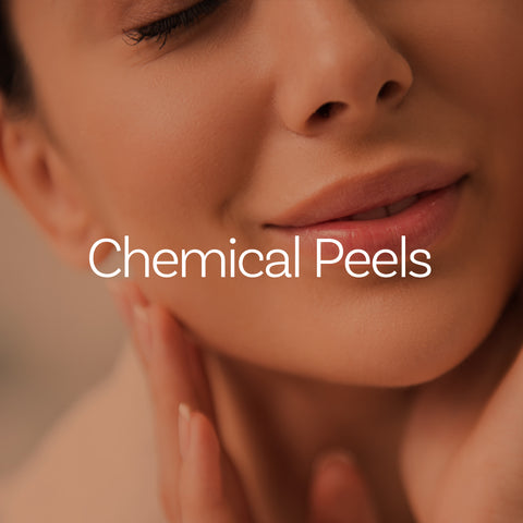 Chemical Peels (AZ Only)